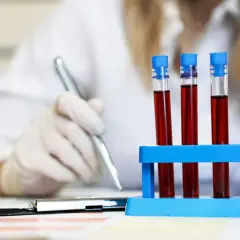 Laborantka w białej rękawiczce pisze coś długopisem, obok stoją probówki z krwią.INR.