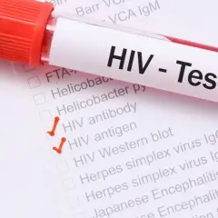 Probówka z krwią do testu na HIV. Zaznaczone "HIV antibody" i "HIV antigen".