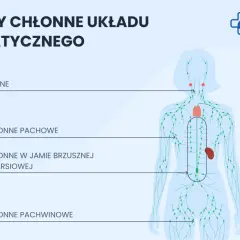 Schemat układu limfatycznego z zaznaczonymi węzłami chłonnymi szyjnymi, pachowymi, w jamie brzusznej i klatce piersiowej oraz pachwinowymi.