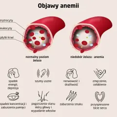 Objawy anemii: bladość skóry, spadek energii, szumy uszne, nerwowość, zmęczenie, bóle głowy, spadek koncentracji, pogorszenie stanu skóry i wypadanie włosów, zaburzenia smaku, przyspieszone bicie serca.