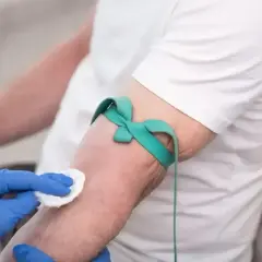 Ręka pacjenta z opaską uciskową i wacikiem, przygotowywana do pobrania krwi na badanie antygenu HBs.