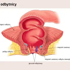 Anatomia odbytnicy z widocznymi polipami. Ilustracja pokazuje mięsień dźwigacz odbytu, mięśnie zwieracze odbytu wewnętrzny i zewnętrzny oraz gruczoły odbytowe.