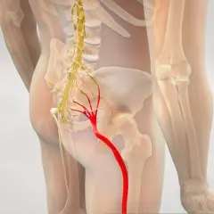 Anatomical illustration showing the sciatic nerve (nerw kulszowy) in red, originating from the lower spine and extending down the leg.