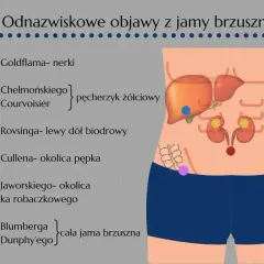 Ilustracja pokazuje lokalizację objawów brzusznych, w tym objaw Jaworskiego w okolicy wyrostka robaczkowego, który może sygnalizować, jak boli wyrostek.