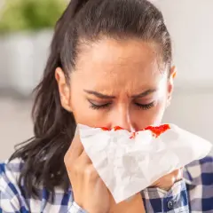Kobieta z zaciśniętymi ustami przykłada do nosa chusteczkę, na której widać ślady krwi. To nieprzyjemne krew z nosa.