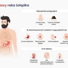 Objawy raka żołądka: utrata masy ciała, czarne stolce, uczucie pełności, niestrawność, zgaga, utrata apetytu, nudności, wymioty, osłabienie, ból pleców, trudności w połykaniu.