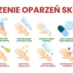 Porady dotyczące leczenia oparzeń skóry: chłodna woda, maść z antybiotykiem, zimny kompres, leki przeciwbólowe, aloes. Unikaj masła, jajka, pasty do zębów, lodu.