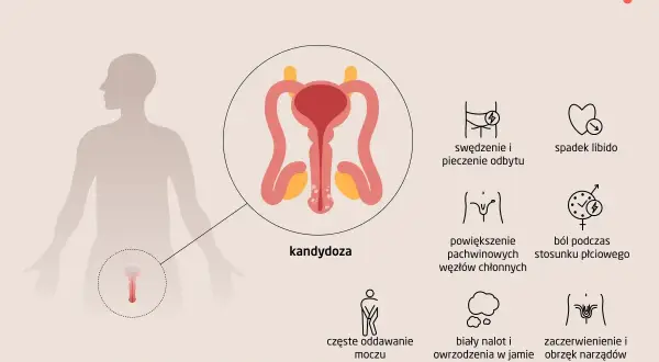 Objawy kandydozy u mężczyzn: swędzenie, ból, spadek libido. Domowe leczenie grzybicy prącia może pomóc.