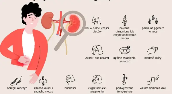 Ilustracja przedstawia objawy niewydolności nerek: ból pleców, obrzęki, nudności, zmiana moczu, gorączka, wysokie ciśnienie krwi.