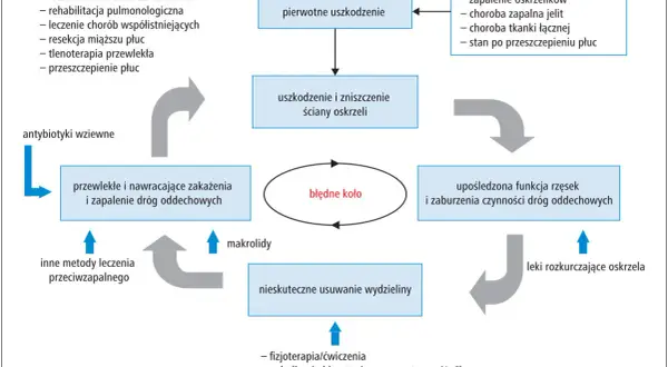 Schemat cyklu rozwoju rozstrzenia oskrzeli: pierwotne uszkodzenie prowadzi do zniszczenia ściany oskrzeli, upośledzenia funkcji rzęsek i nawracających zakażeń.