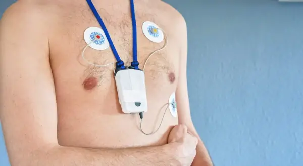 Mężczyzna z przyklejonymi elektrodami i urządzeniem holter ekg na klatce piersiowej, monitorującym pracę serca.