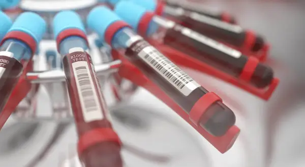 Probówki z krwią w wirówce laboratoryjnej. Wyniki badań wskazują na podwyższone bazocyty, co może wymagać dalszej diagnostyki.