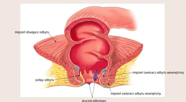 Anatomia odbytnicy z widocznymi polipami. Ilustracja pokazuje mięsień dźwigacz odbytu, mięśnie zwieracze odbytu wewnętrzny i zewnętrzny oraz gruczoły odbytowe.