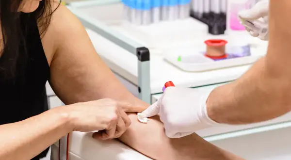 Pobieranie krwi do badań. Pacjentka ma lekko widoczne żyły, co ułatwia procedurę. Wyniki badań MPV niskie mogą wskazywać na pewne schorzenia.