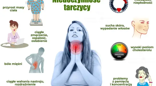 Ilustracja przedstawia objawy niedoczynności tarczycy: przyrost masy ciała, zmęczenie, bóle mięśni, wahania nastroju, suchą skórę, wypadanie włosów, wysoki cholesterol, problemy z pamięcią.
