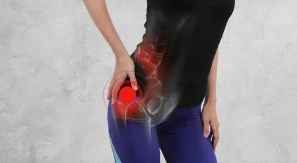 Ból biodra z powodu koksartrozy, zaznaczony czerwonymi kręgami.