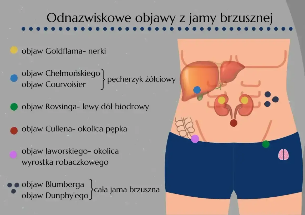 Ilustracja pokazuje lokalizację objawów brzusznych, w tym objaw Jaworskiego w okolicy wyrostka robaczkowego, który może sygnalizować, jak boli wyrostek.