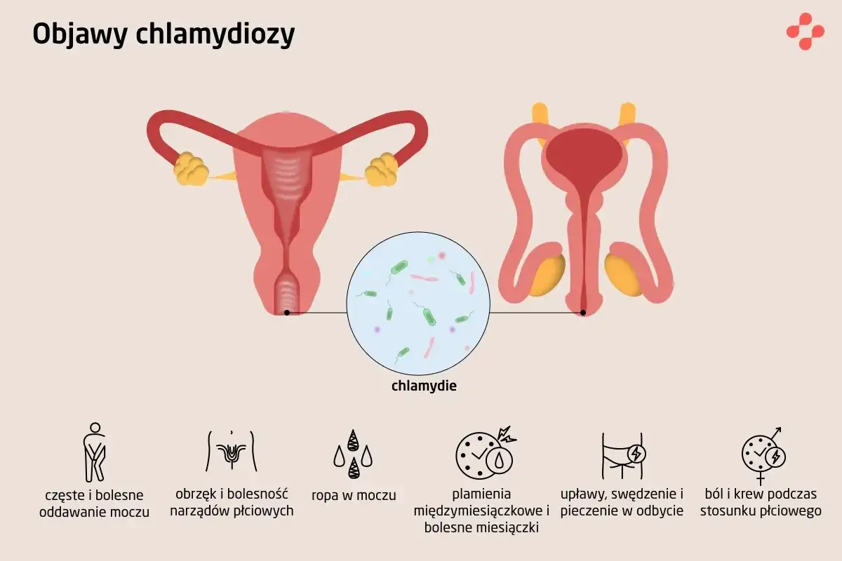 Ilustracja przedstawia układ rozrodczy kobiety i mężczyzny, a także powiększenie bakterii chlamydii. Wymienione są objawy chlamydiozy: ból przy oddawaniu moczu, obrzęk narządów płciowych, ropa w moczu, plamienia, upławy i ból podczas stosunku.