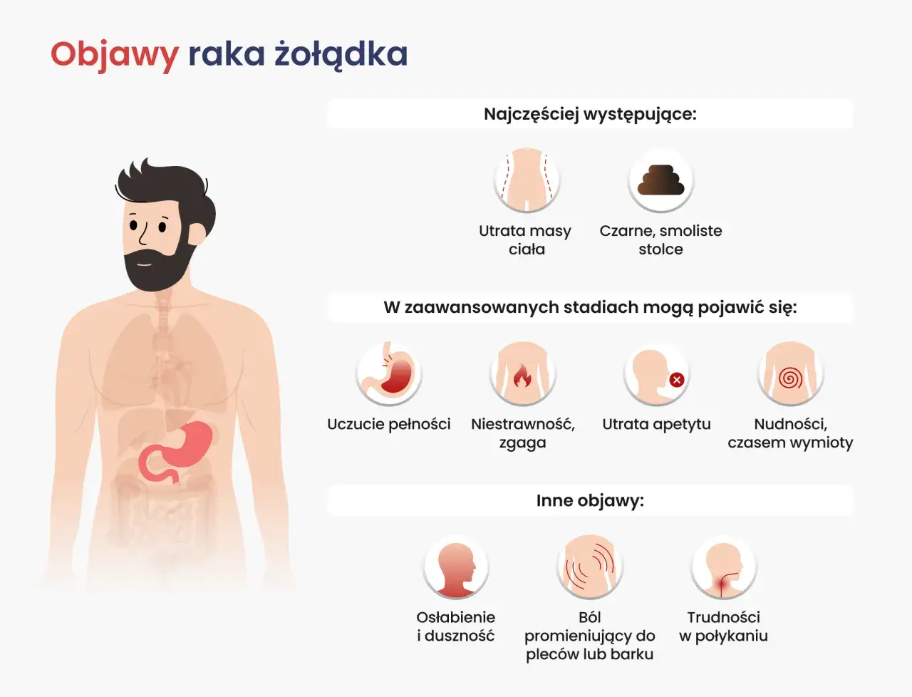 Ilustracja przedstawia objawy raka żołądka: utratę masy ciała, czarne stolce, uczucie pełności, niestrawność, zgagę, utratę apetytu, nudności, wymioty, osłabienie, ból pleców i trudności w połykaniu.