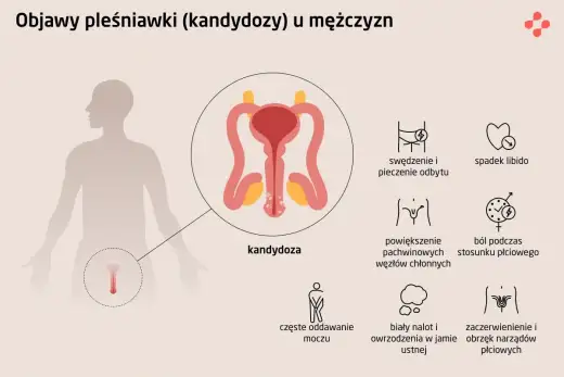 Grzybica prącia - Objawy, leczenie i kiedy do lekarza?