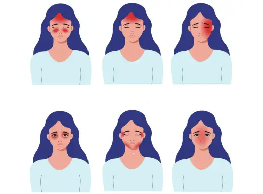 Ból skroni - Kiedy to migrena, a kiedy sygnał alarmowy?