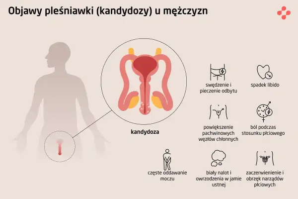 Objawy kandydozy u mężczyzn: swędzenie, ból, spadek libido. Domowe leczenie grzybicy prącia może pomóc.