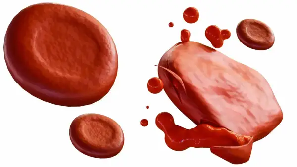 Czerwone krwinki, jedna z nich pęka, uwalniając zawartość. To obraz hemolizy, procesu rozpadu erytrocytów.