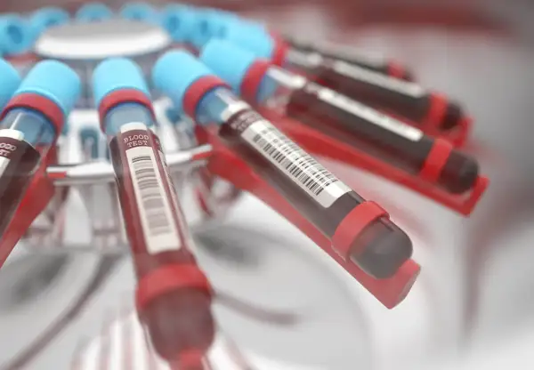 Probówki z krwią w wirówce laboratoryjnej. Wyniki badań wskazują na podwyższone bazocyty, co może wymagać dalszej diagnostyki.