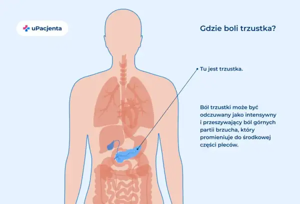 Anatomia człowieka z zaznaczoną trzustką. Ból trzustki odczuwany jest w górnej części brzucha, promieniując do pleców.