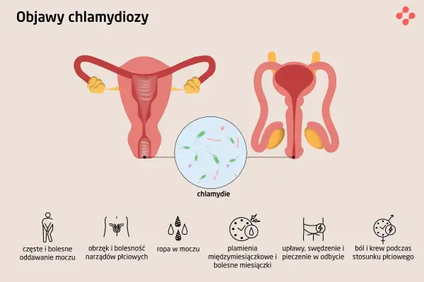 Ilustracja przedstawia układ rozrodczy kobiety i mężczyzny, a także powiększenie bakterii chlamydii. Wymienione są objawy chlamydiozy: ból przy oddawaniu moczu, obrzęk narządów płciowych, ropa w moczu, plamienia, upławy, swędzenie i ból podczas stosunku.