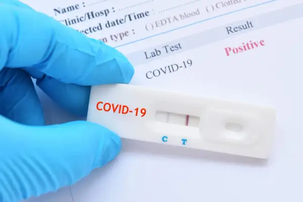 Ręka w niebieskiej rękawiczce trzyma test antygenowy COVID-19 z dwoma widocznymi paskami, wskazującymi na wynik pozytywny.
