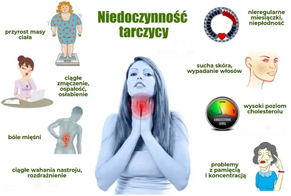 Ilustracja przedstawia objawy niedoczynności tarczycy: przyrost masy ciała, zmęczenie, bóle mięśni, wahania nastroju, suchą skórę, wypadanie włosów, wysoki cholesterol, problemy z pamięcią.