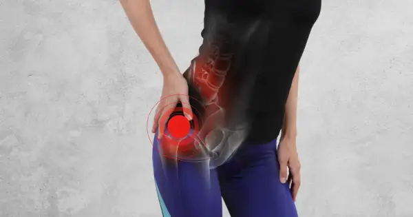 Ból biodra z powodu koksartrozy, zaznaczony czerwonymi kręgami.