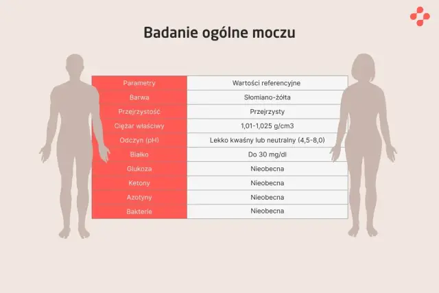 Posiew moczu - Co oznacza wynik i kiedy leczyć?
